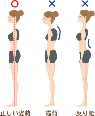 正しい姿勢・猫背・反り腰のイラスト