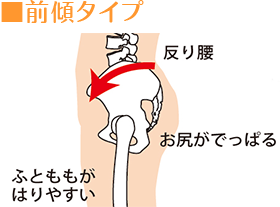 前傾タイプ