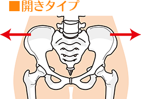 開きタイプ